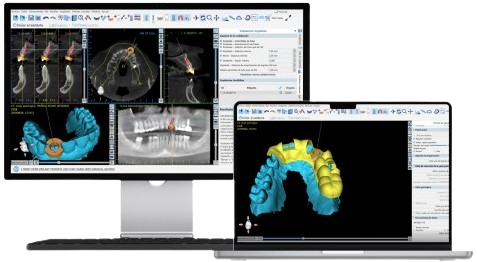 Software de planificación digital dental con CBCT y modelo 3D